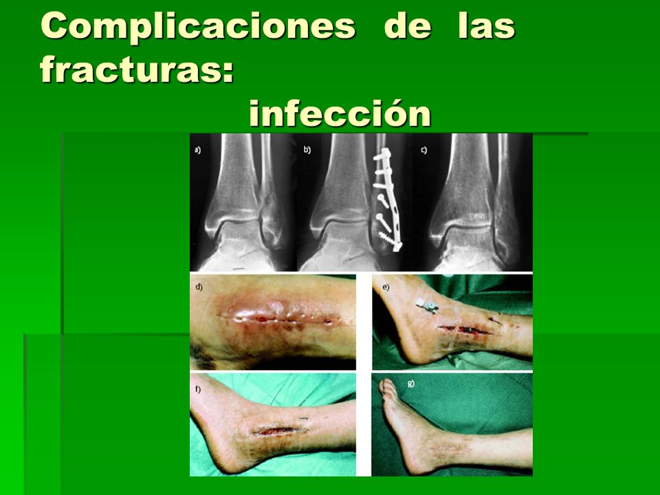 El mensaje del daño del alcohol y las medidas de las prevenciones del alcoholismo